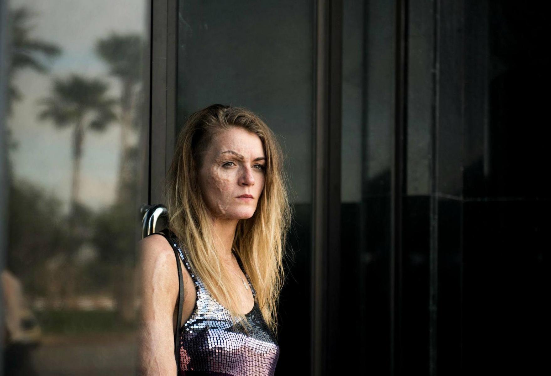 Юкине скверна. Скверный бог. Бишамон аниме. Айха бездомный бог. Vicky knight.