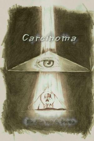 Carcinoma 
