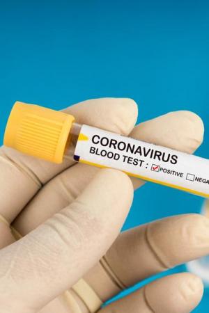 Coronavirus (TV)