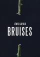 Lewis Capaldi: Bruises (Vídeo musical)
