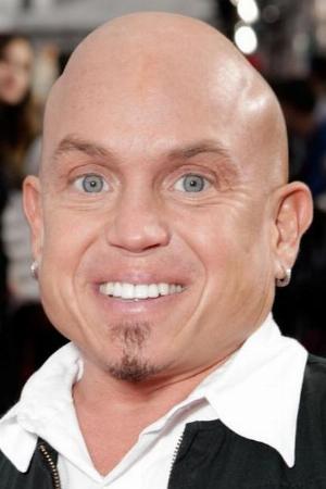 Martin Klebba