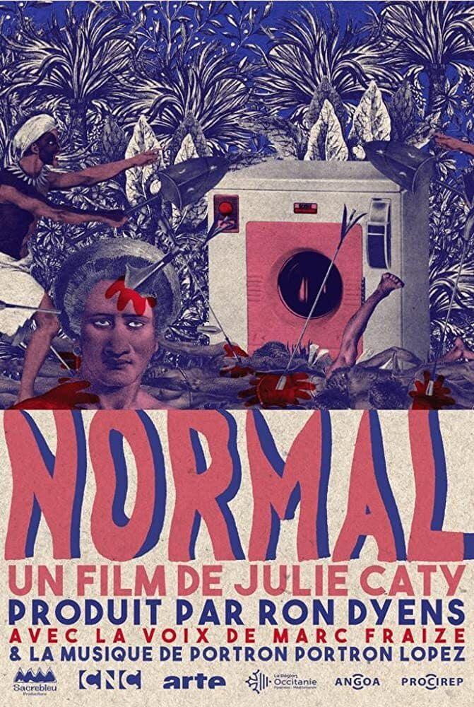 Normal (S)