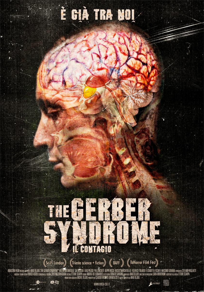 The Gerber Syndrome: il contagio 