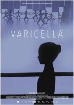 Varicella (S)