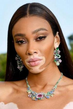 Winnie Harlow